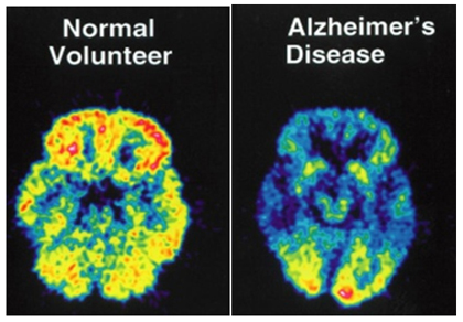 Images of a SPECT scan